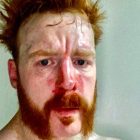 Mise à jour sur les blessures de Sheamus et selfie sanglant de WWE RAW 