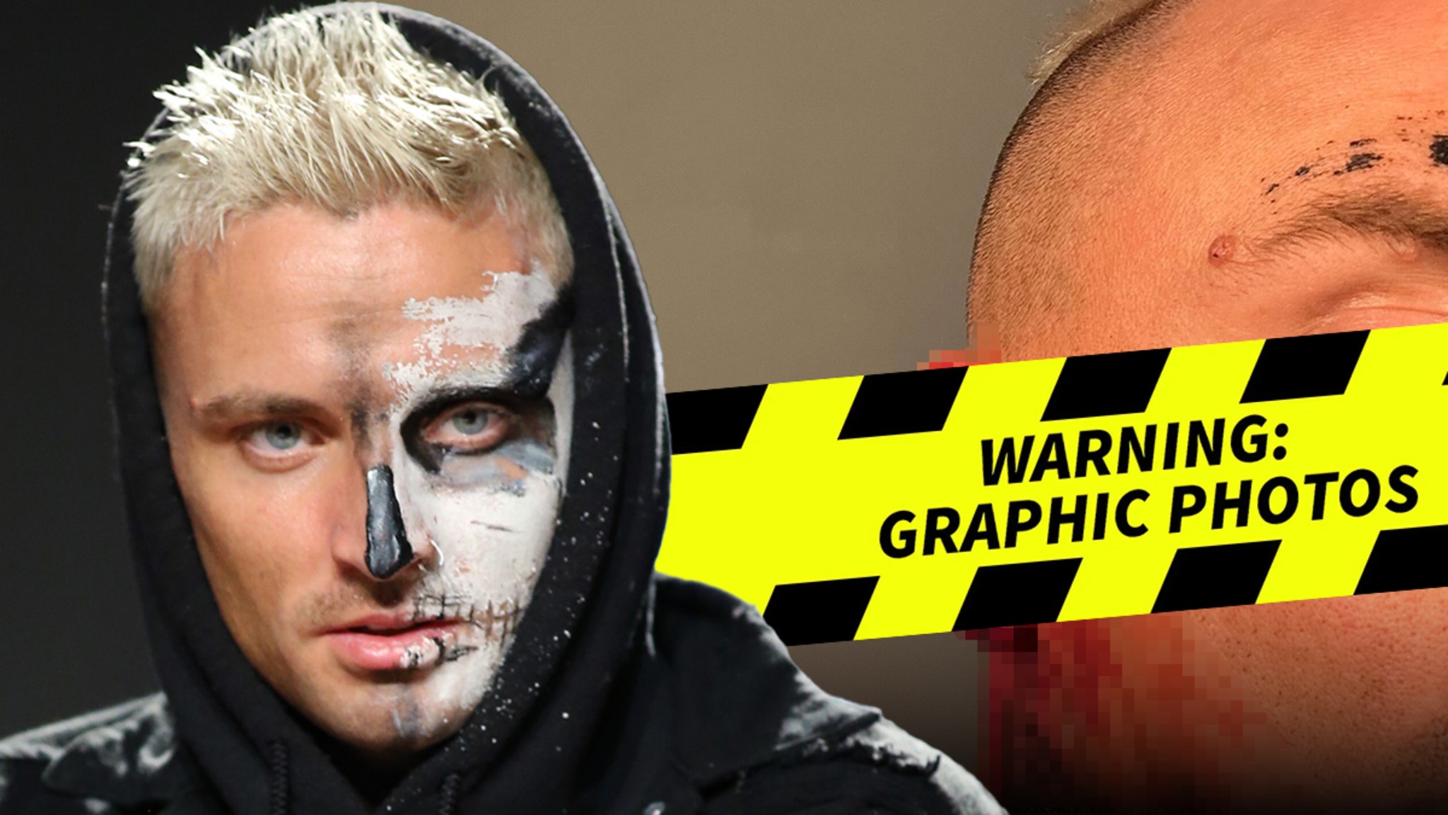AEW Star Darby Allin Flaunts Nasty Ear Injury in Bloody Photo